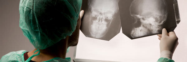 Doctor examining xray of injuries 